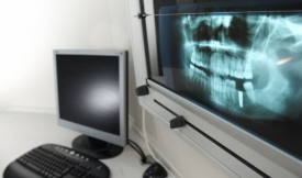 Jak często wykonywać zdjęcie rentgenowskie zębów?