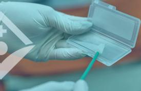 Cytologia ratuje życie – bezpłatne badania dla kobiet z powiatu suskiego.